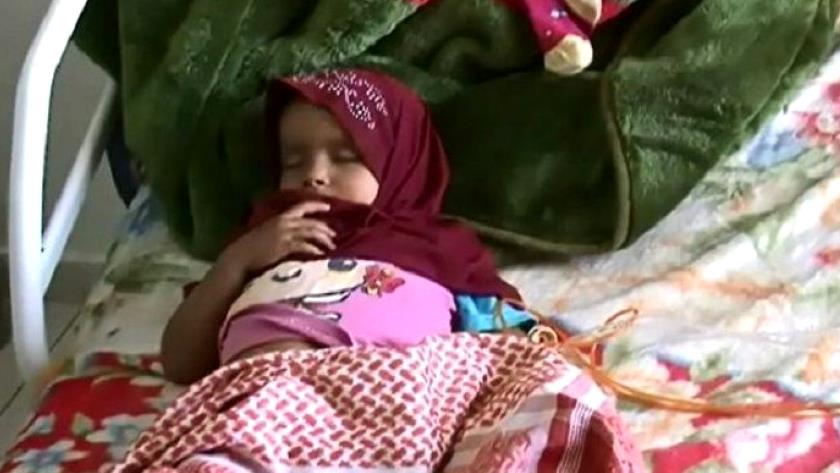 Iranpress: Cancer growing among Yemenis due to Saudis