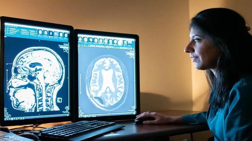 Iranpress: Results for ultrasound treatment of Alzheimer