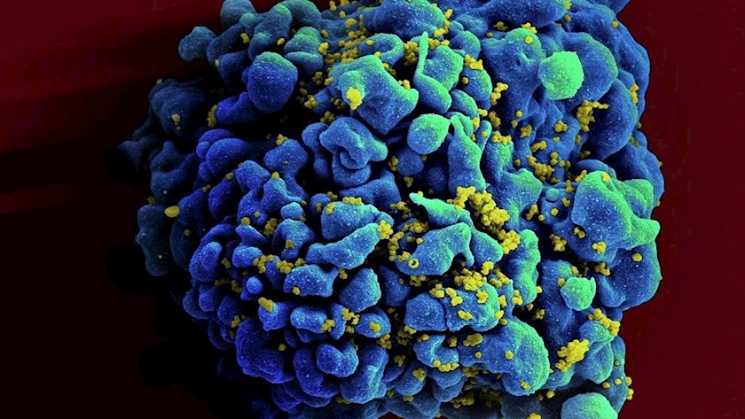 Iranpress: Scientists develop method to kick and kill hidden HIV in cells