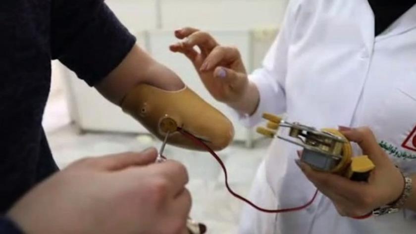 Iranpress: Frist Iran-made robotic hand prosthesis enters mass-production