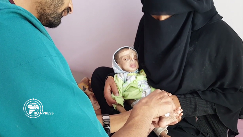 Poor condition of children in Al-Sabeen Hospital, Yemen