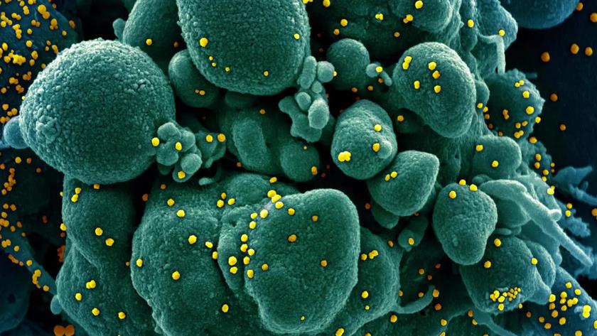 Iranpress: US coronavirus deaths surpass 225,000
