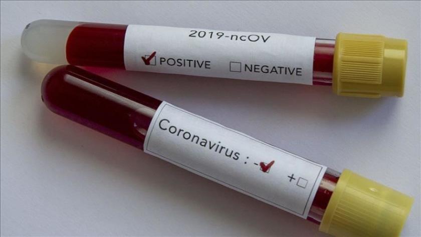 Iranpress: Coronavirus kills at least 1.3, infects near 54 millions globally so far
