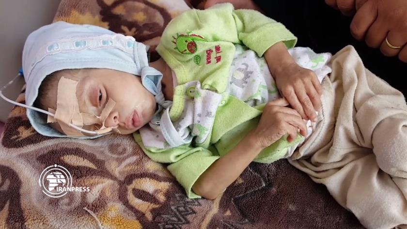 Iranpress: Yemeni children and the silent death