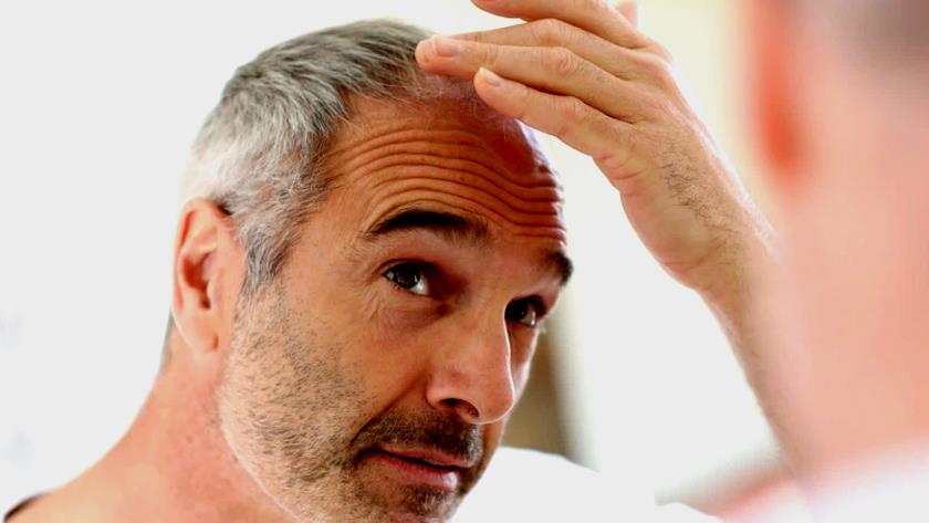Iranpress: A possible miracle cure for baldness