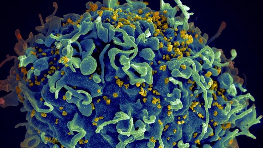 Iranpress: UN urges action to end AIDS, saying COVID-19 hurt progress