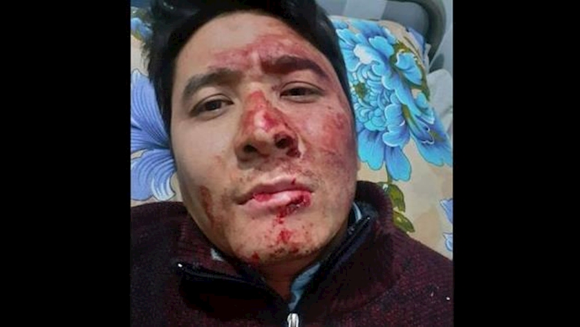 Iranpress: IRIB cameraman comes under attack in Kabul