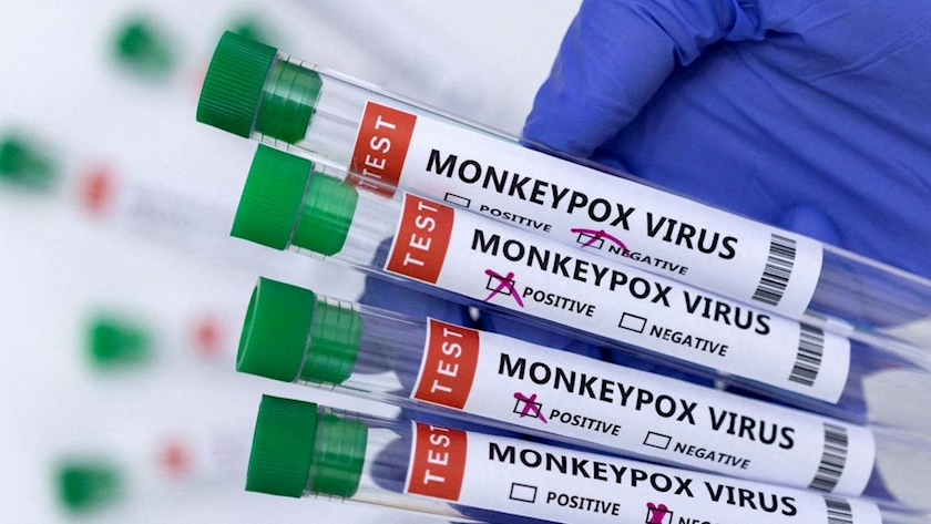Iranpress: US monkeypox case count rises to nearly 17,000