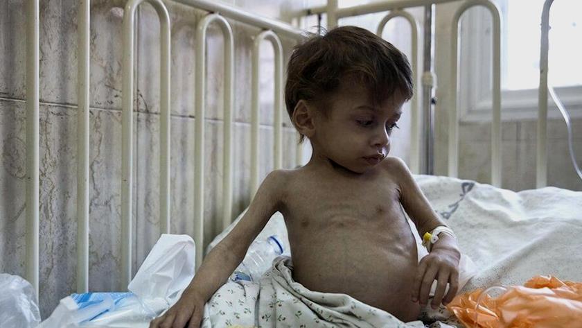 Iranpress: Some 50 Gazan children suffer malnutrition in just one week