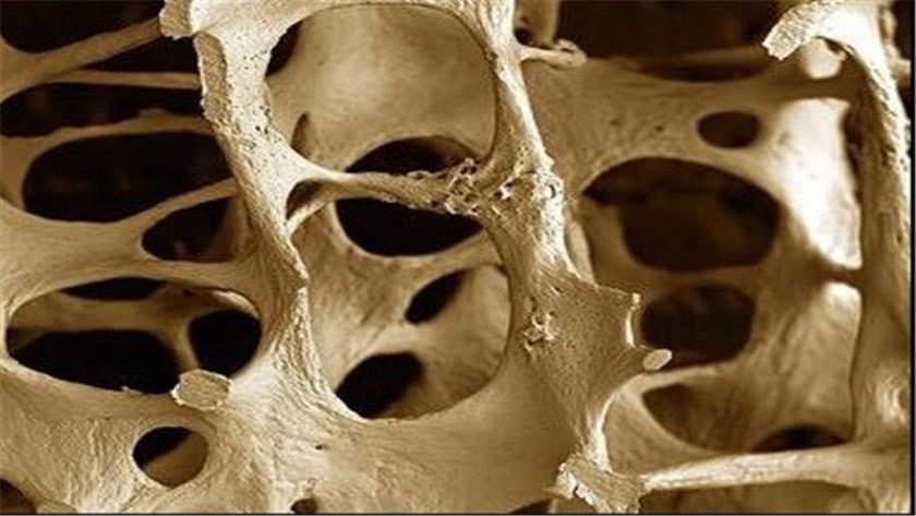 Iranpress:  Iranian Researcher Develops Bioactive Injectable Paste to Enhance Bone Regeneration