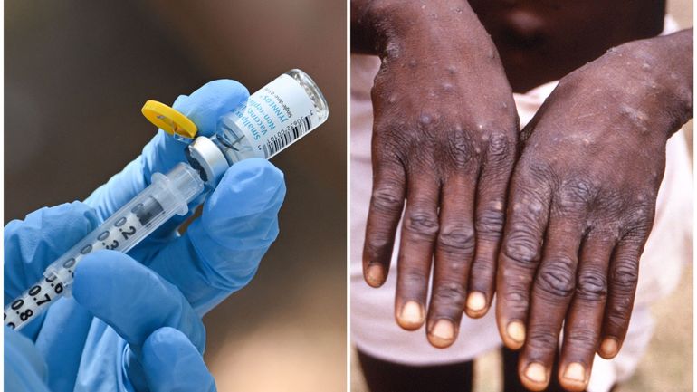 Iranpress: L’Afrique a besoin de davantage de vaccins contre le mpox, affirme MSF